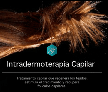 mesoterapia capilar