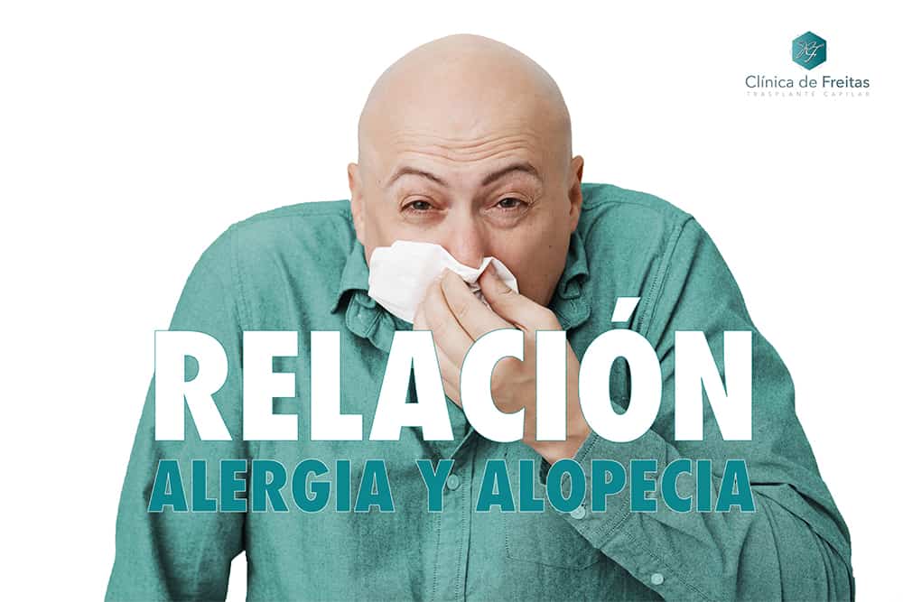 ALERGIA Y ALOPECIA AREATA