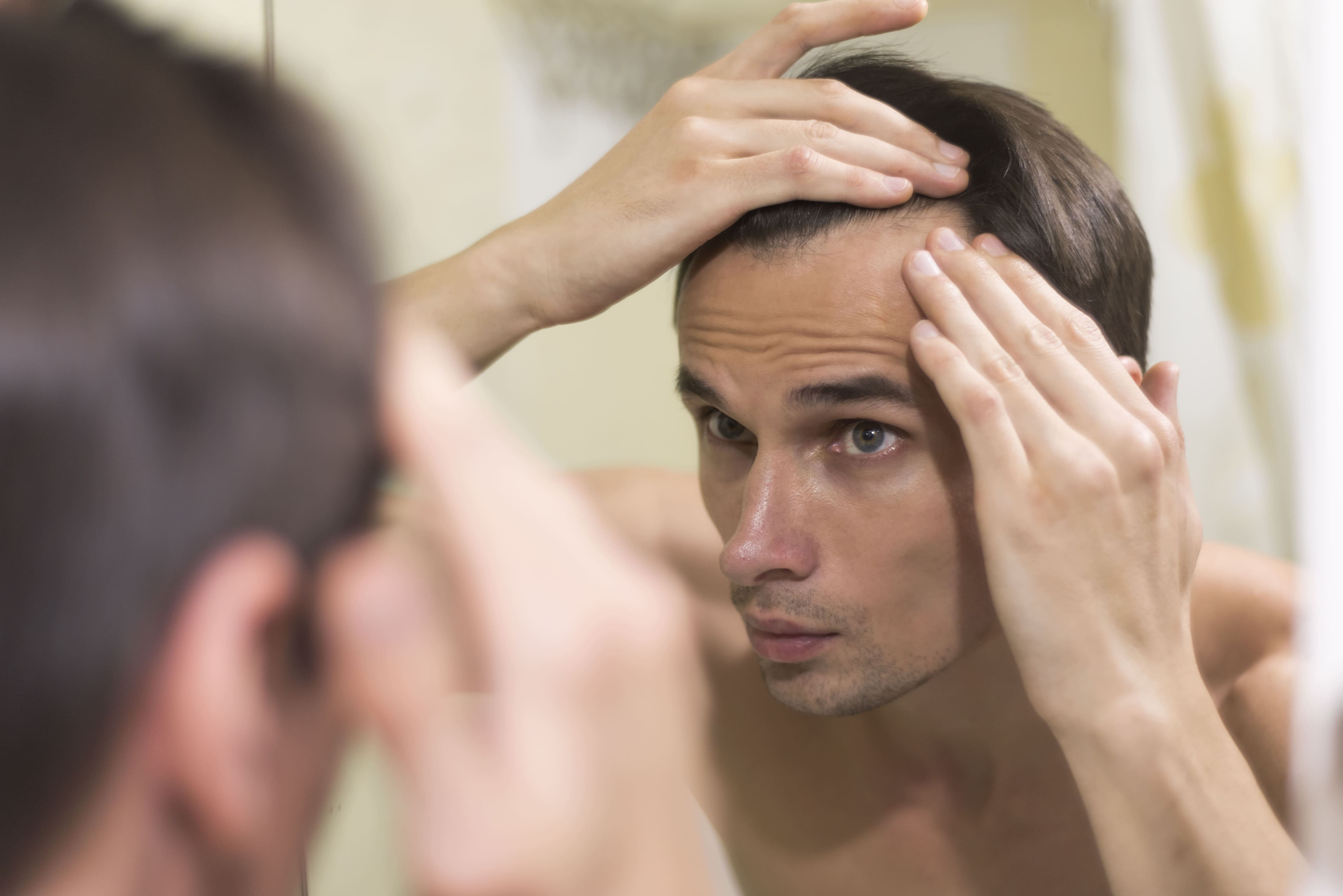 como recuperar pelo en entradas recuperar el pelo de las entradas