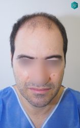 ANTES PRIMERA INTERVENCIÓN ANTES PRIMERA INTERVENCIÓN