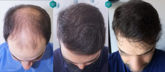 COMPARATIVA ANTES Y DESPUÉS COMPARATIVA ANTES Y DESPUÉS