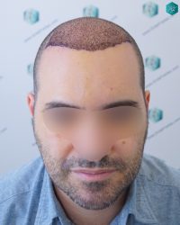 RESULTADOS A LOS 3 DÍAS RESULTADOS A LOS 3 DÍAS