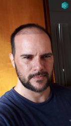 RESULTADOS AL 2º MES RESULTADOS AL 2º MES