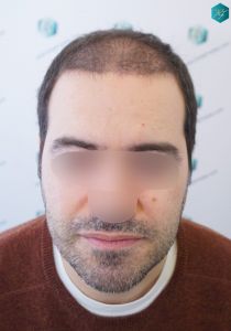 RESULTADOS EN 3 MESES RESULTADOS EN 3 MESES