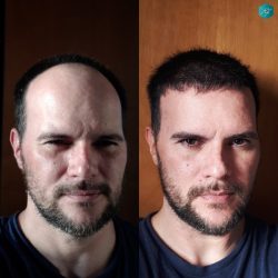 RESULTADOS 7º MES RESULTADOS AL 7º MES