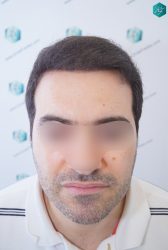 RESULTADOS EN 6 MESES RESULTADOS EN 6 MESES