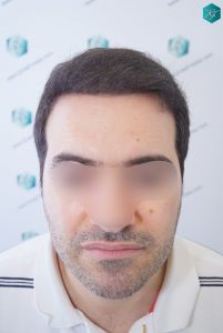 RESULTADOS EN 6 MESES RESULTADOS EN 6 MESES