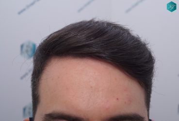 RESULTADO FINAL EN 12 MESES RESULTADO FINAL EN 12 MESES