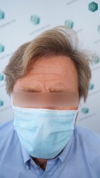 RESULTADOS A LOS 12 MESES 23 RESULTADOS A LOS 12 MESES