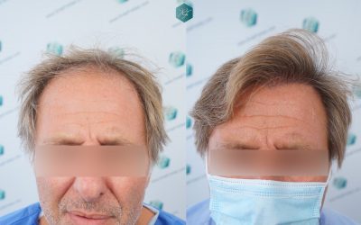 COMPARATIVAS ANTES Y DESPUÉS 40 COMPARATIVAS