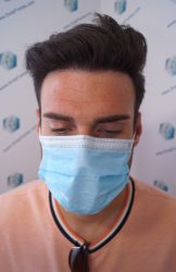 RESULTADOS A LOS 9 MESES 17 RESULTADOS TRASPLANTE CAPILAR 9 MESES 17