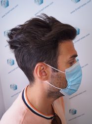 Injerto Capilar Técnica FUE Grafts 2271 (6310 Pelos) 16 19 RESULTADOS TRASPLANTE CAPILAR 9 MESES 19