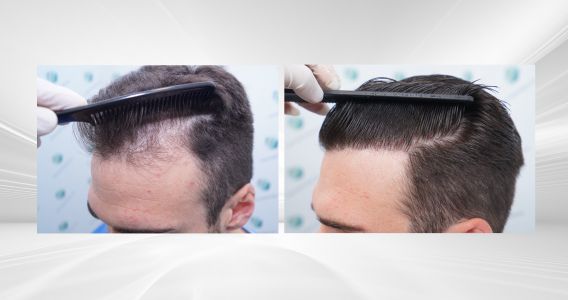 COMPARATIVAS X COMPARATIVAS 3