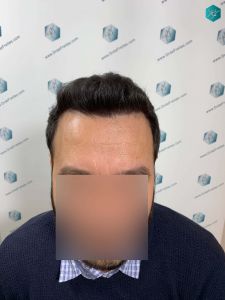 RESULTADOS A LOS 12 MESES 20 RESULTADOS A LOS 12 MESES