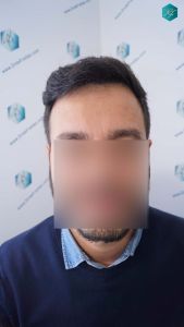 RESULTADOS A LOS 9 MESES 2º INTERVENCIÓN 47 RESULTADOS A LOS 9 MESES