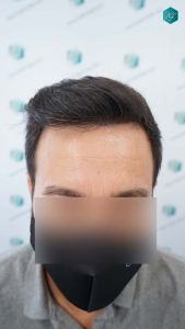 RESULTADOS A LOS 12 MESES 62 RESULTADOS A LOS 12 MESES