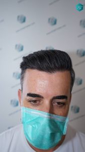 RESULTADOS A LOS 12 MESES 8 RESULTADOS A LOS 12 MESES