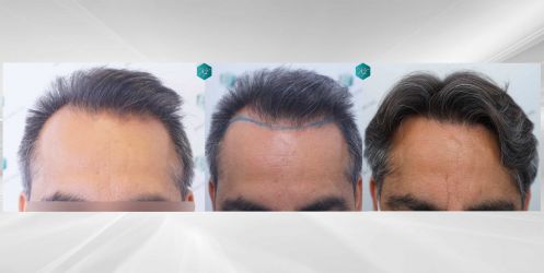 COMPARATIVAS I COMPARATIVAS
