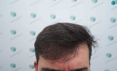 26 RESULTADOS A LOS 12 MESES