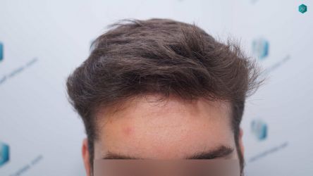 RESULTADOS A LOS 12 MESES 26A RESULTADOS A LOS 12 MESES