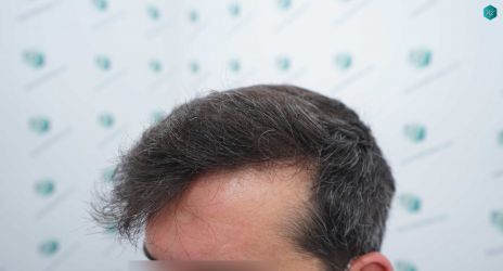 31 RESULTADOS A LOS 12 MESES