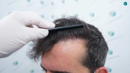 39 RESULTADOS A LOS 12 MESES