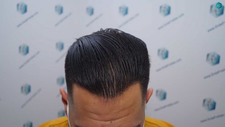 34B RESULTADOS 12 MESES