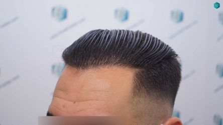 37 RESULTADOS 12 MESES