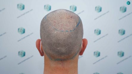 19 DISENO LINEA INJERTO