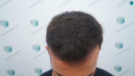 27C RESULTADOS A LOS 12 MESES