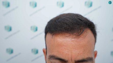 28 RESULTADOS A LOS 12 MESES