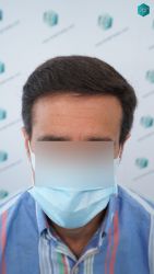 RESULTADOS A LOS 12 MESES 38 RESULTADOS A LOS 12 MESES