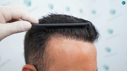 52B RESULTADOS A LOS 12 MESES