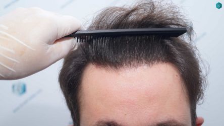 30 RESULTADOS 12 MESES