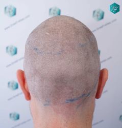 16 DISENO LINEA INJERTO