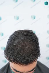 69 RESULTADOS A LOS 12 MESES
