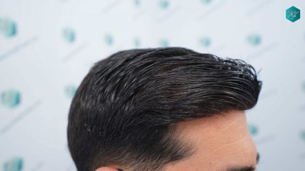 71 RESULTADOS A LOS 12 MESES