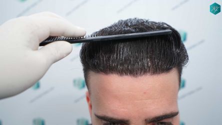 28A RESULTADOS 12 MESES
