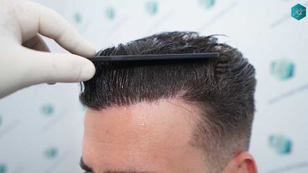 30 RESULTADOS 12 MESES