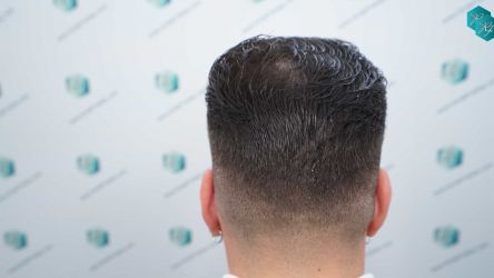 33 RESULTADOS 12 MESES