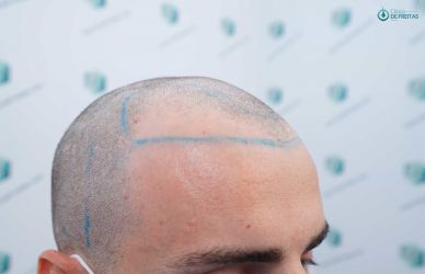 14 DISEÑO LINEA INJERTO