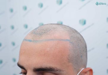 15 DISEÑO LINEA INJERTO