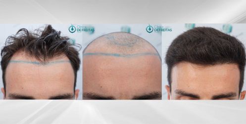 4 COMPARATIVA