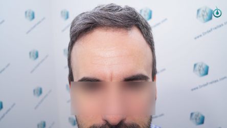 RESULTADOS 6 MESES 28 RESULTADOS 6 MESES