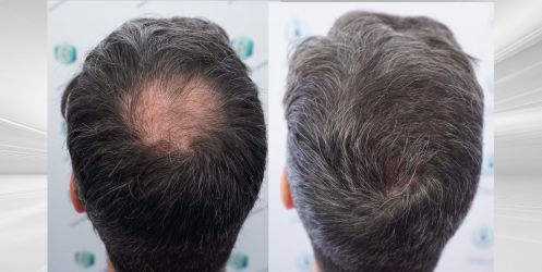 48 ANTES Y DESPUES 48 ANTES Y DESPUES